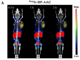 试点研究：基于新型肽类示踪剂99mTc-HP-Ark2对乳腺癌患者HER2的分子成像
