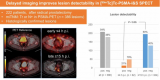 延迟SPECT改善前列腺癌检测