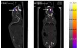 通过对流增强递送β粒子发射放射性核素Lu177标记的金纳米颗粒治疗NRG小鼠原位U251人多形性胶质母细胞瘤