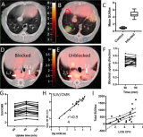 [18F]FDT在结核病中临床前应用研究