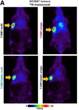 PET成像验证普通降胆固醇药物可增强HER2靶向癌症治疗