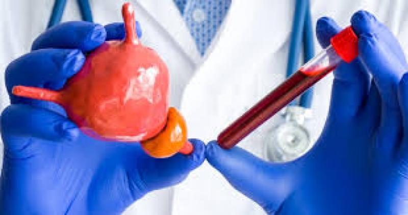 艾赛普生物泛肿瘤荧光显像剂创新药物iSAP-0909获FDA临床试验批准