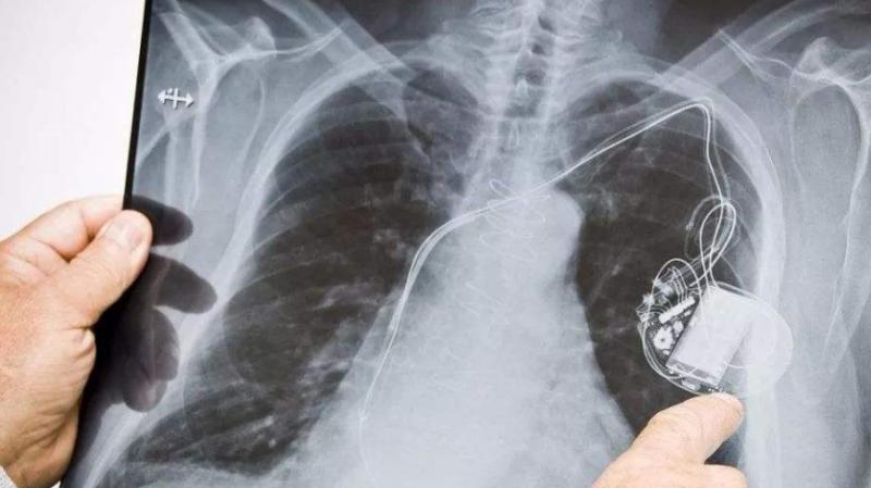 西南地区重点核技术医用项目辐射安全研讨会顺利召开