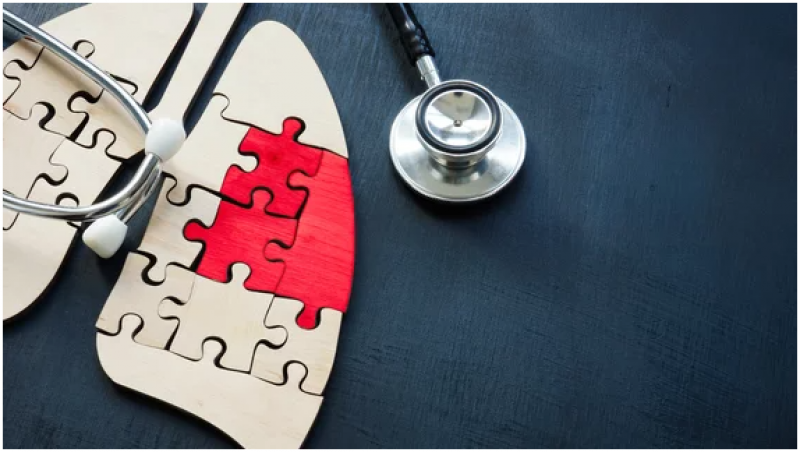 新型PET方法将抗体与放射性同位素相结合，以提高肺癌检测率