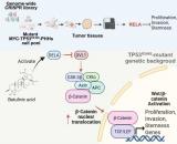 TP53突变肝癌新机制为精准治疗指明潜在靶点