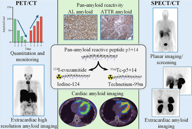 核心脏病学技术持续革新 超越传统灌注成像范畴