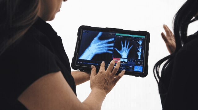 动态数字射线照相：革新临床诊断的动态成像利器