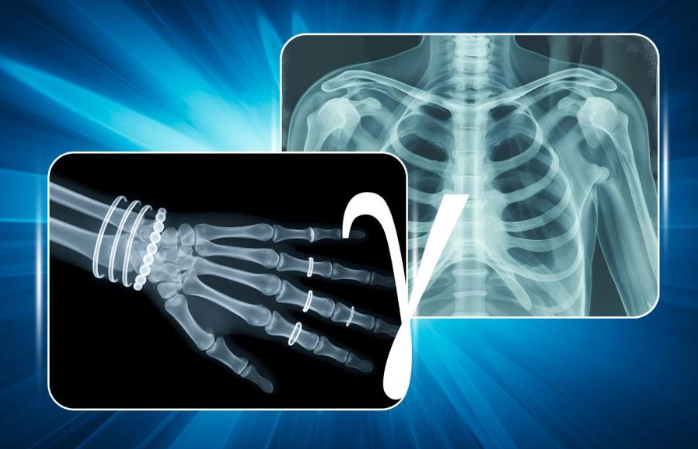 俄罗斯突破核技术瓶颈 研发出高亮度紧凑型伽马射线源新方法