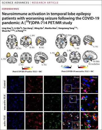湘雅医院胡硕教授团队和冯莉教授团队合作在《Science Advances》与《Advanced Science》期刊连续发表原创研究成果