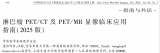 淋巴瘤PET/CT及PET/MR临床应用指南（2025版）要点发布