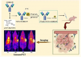 首都医科大学附属北京友谊医院核医学科杨吉刚团队：靶向SEZ6用于小细胞肺癌的新型免疫PET探针[⁶⁴Cu]Cu-NOTA-GGB02-F9
