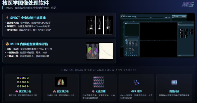 核医学成像新技术探索：¹⁷⁷Lu级联符合成像的原理与挑战