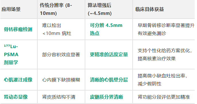 算法革新推动核医学技术升级 SPECT分辨率突破物理极限至4.5毫米