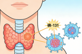 解读甲状腺癌碘-131治疗后TgAb阳性的临床意义与应对策略