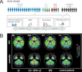PET可显示自身免疫性脑炎的疾病活动度