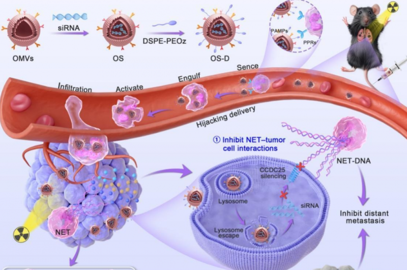 中国团队开发中性粒细胞“劫持”纳米囊泡 协同阻断放疗后NETs介导的肿瘤转移