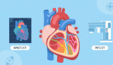 心肌灌注显像，SPECT/CT与PET/CT差异解读